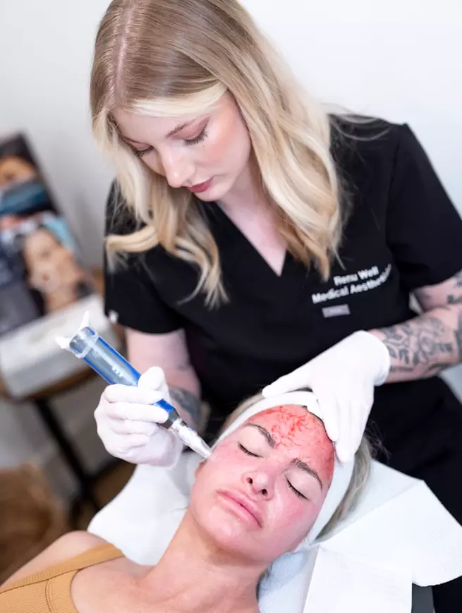 Vi Peel or BioRe3 No Peel Peel (Package of 3)