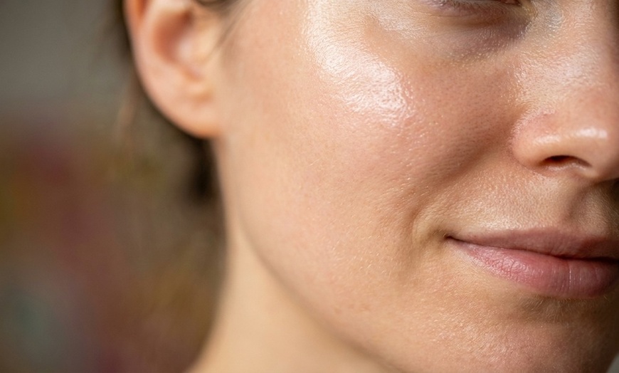 Image 4: Up to 88% Off on Microdermabrasion at Love You Laser