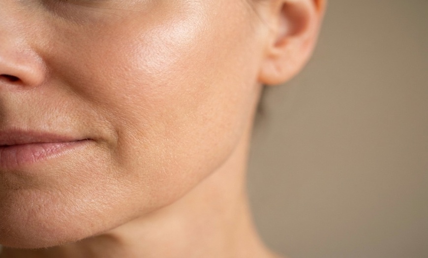 Image 3: Revitalize Your Look with HIFU treatments