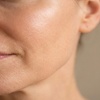 Image 3: Revitalize Your Look with HIFU treatments
