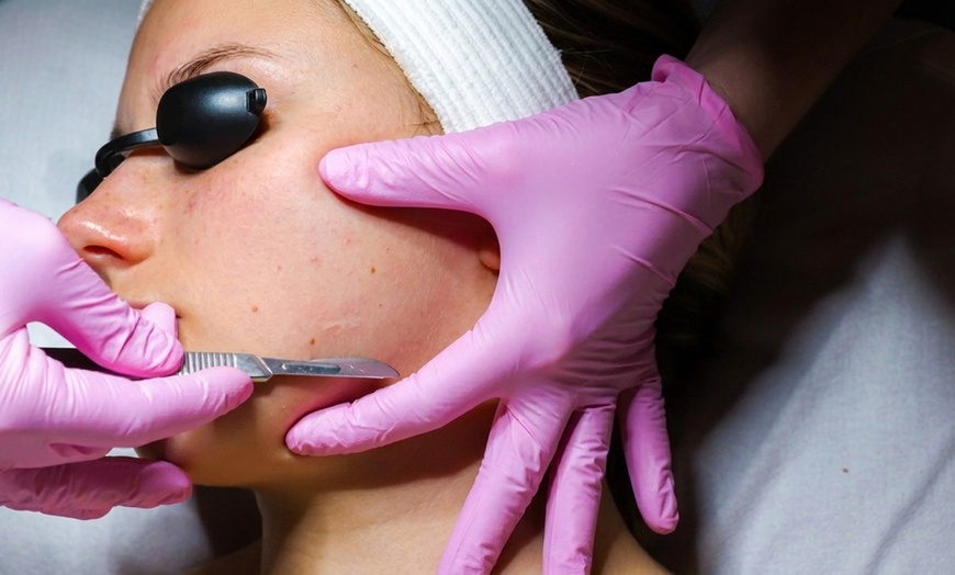 Image 5: Revitalize your Skin with Facials and Microdermabrasion Treatments!