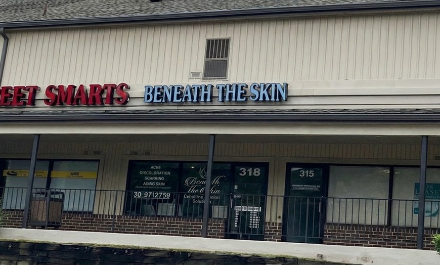 Image 2: Expert One, Three, or Five 60-min Microdermabrasion Facial Sessions