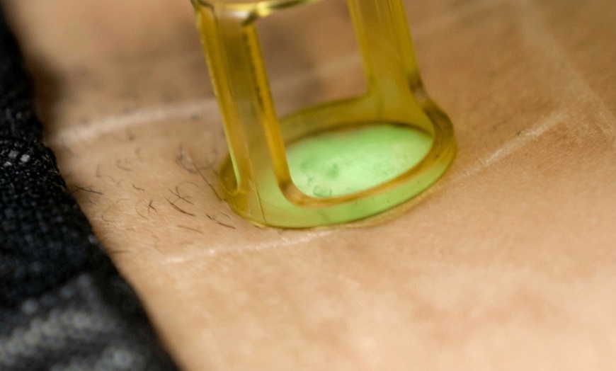 Image 4: Discover Laser Hair Removal at SEV Laser, a Celebrity-Favorite Salon  