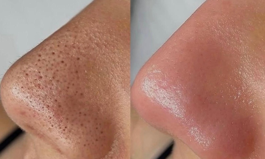 Image 4: Revitalizing Lymphatic Massage & Facial for Radiant Skin