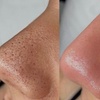 Image 4: Revitalizing Lymphatic Massage & Facial for Radiant Skin