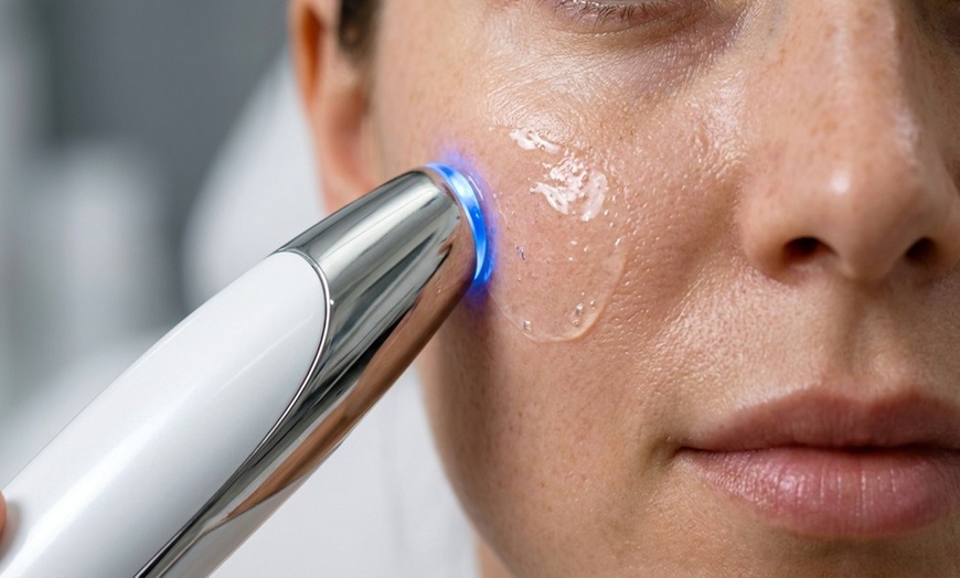 Image 5: Up to 76% Off on Facelift - Non-Surgical at Santorini Spa Llc