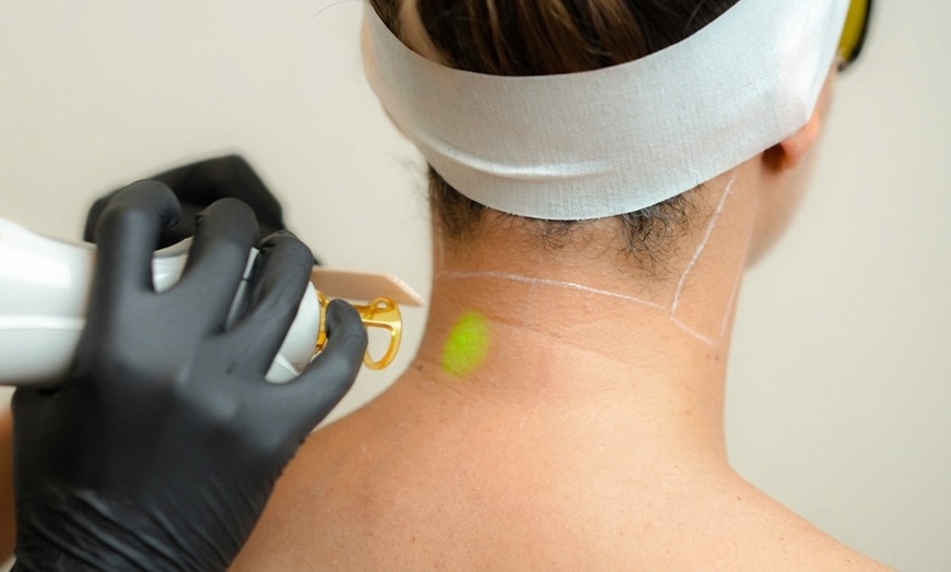 Image 2: Six Laser Hair Removal at SEV Laser, a Celebrity-Favorite Salon  