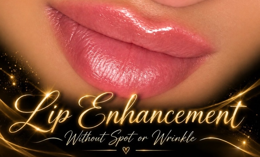 Image 4: Lip Filler and Enhancement Options Using Evolysse