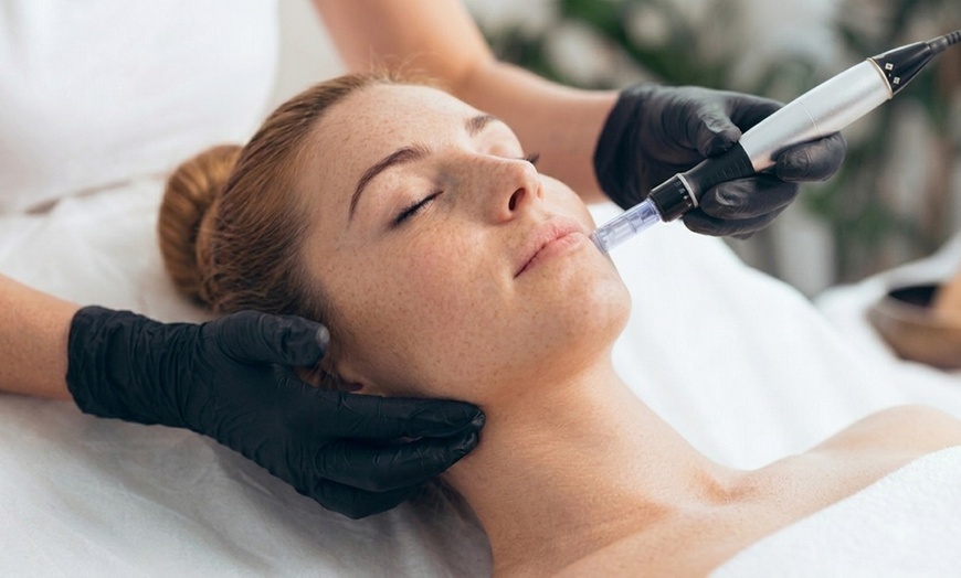Image 2: Micro-Needling + Collagen Induction Therapy for Smoother, Radiant Skin