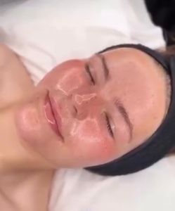 HydraFacial MD Elite with LED Light Therapy & Chakra Realigning Energy Bed - The Bodie Co