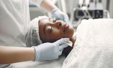 One 60-Minute Acne Facial - EmberBlaze Spa and Beauty