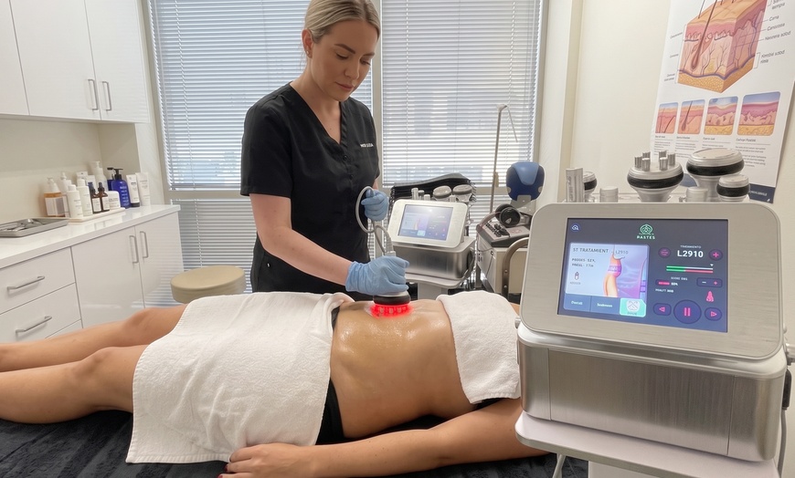 Image 4: Ultrasonic Cavitation & Radio Frequency Skin Tightening