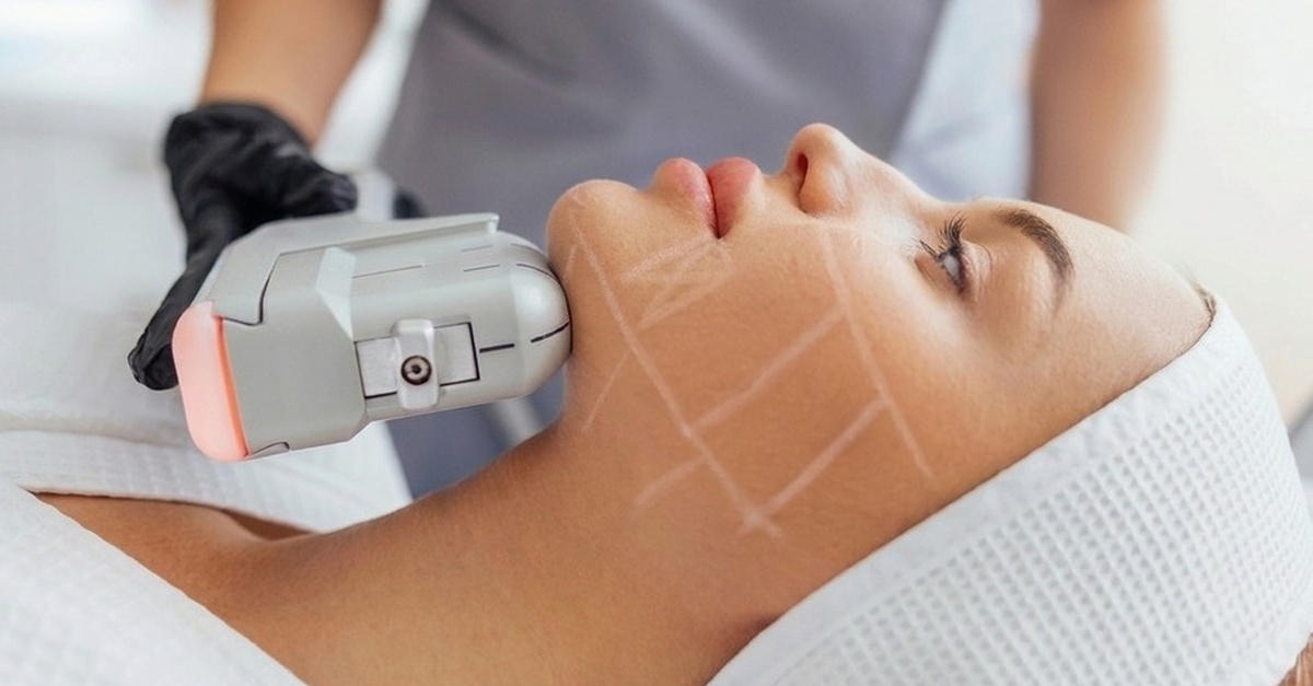 Tratamiento HIFU 7D con radiofrecuencia en Barcelona