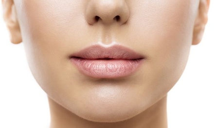 One Syringe of Juvederm Ultra - Spa Bella Medispa