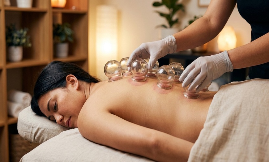 Image 6: Experience Acupuncture and Cupping for Holistic Wellness
