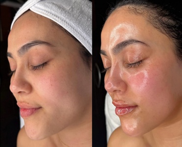 One Session 60 min Lymphatic massage + Oxygen/Collagen Facial - Saloua esthetics