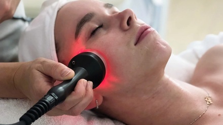 Radiance RF Facial - Tila Medspa