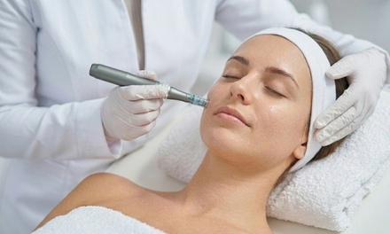 One Microneedling Session - Bala Better Health
