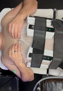 One Exxo Ice Facial & Body Contouring Session - Complexions Body Spa and Permanent Hair Reduction