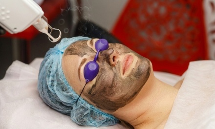 Carbon Peel Laser Treatment - IVE MEDICAL SPA