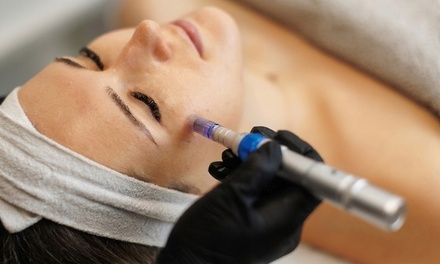 Microneedling with DNA CryoStem Therapy & Skin Analysis Treatment - Primora Spa