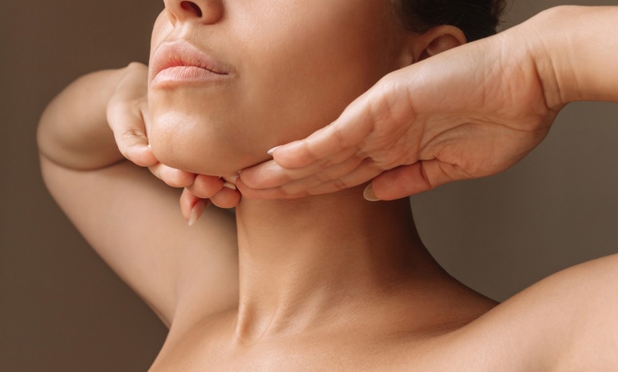 Image 2: Get Smooth Skin with 20 Units of Botox or Botox Lip Flip
