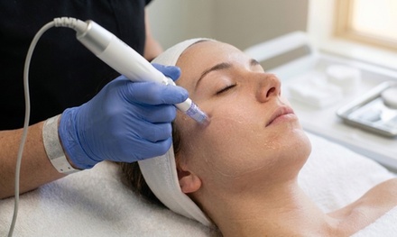 Microneedling Facial with LED Therapy - Aesthetics & Beauty by Claudia