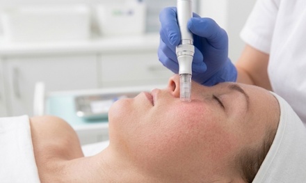 One Micro-needling Treatment for Full Face - Olivo Med Spa