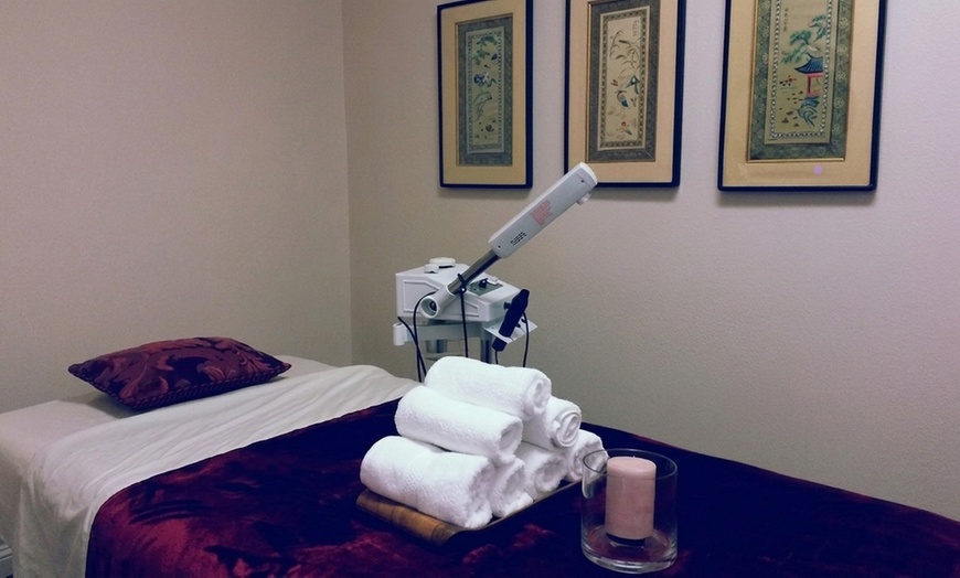Image 3: Advanced IPL Treatments to Diminish Dark Spots, Redness & Fine Lines 