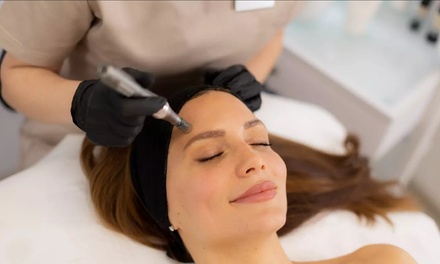 1 Microneedling with PRP and Hyaluronic Acid - Seemas Botox and Aesthetics