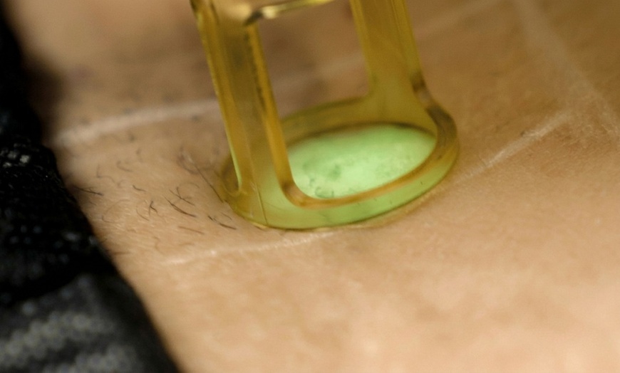 Image 2: Discover Laser Hair Removal at SEV Laser, a Celebrity-Favorite Salon  