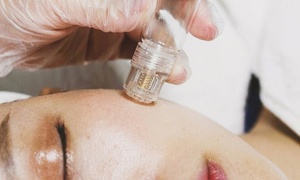 Micro infusion Treatments with Custom Peptides Up To 50% at Rachel Med Spa
