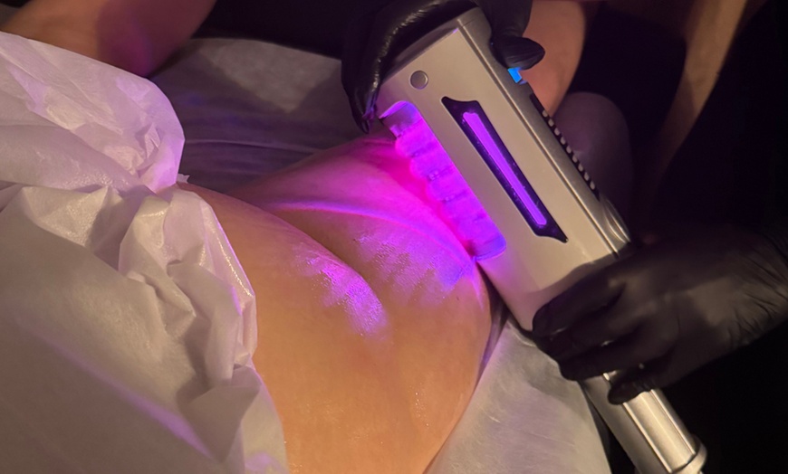 Image 2: Up to 55% Off on Radio Frequency Skin Tightening at Your Sculpt Studio