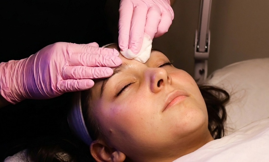 Image 3: Revitalize your Skin with Facials and Microdermabrasion Treatments!
