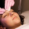 Image 3: Revitalize your Skin with Facials and Microdermabrasion Treatments!