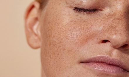 20 Units of Botox - Dermacare - San Juan Capistrano
