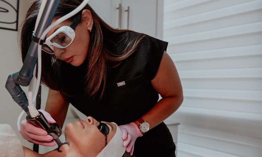 Image 5: CO2 Laser Skin Resurfacing for Wrinkles and Scars
