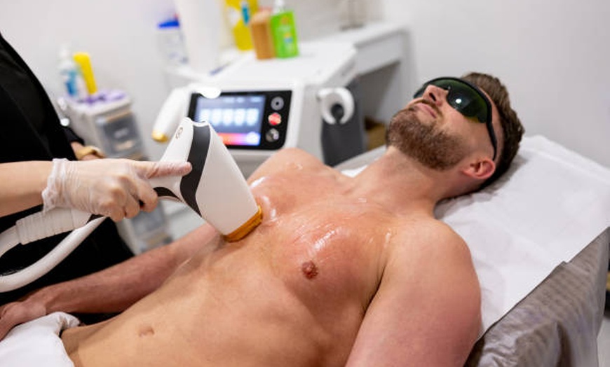 Image 6: Six Laser Hair Removal Treatments on a Small, Medium or Large Area