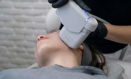 One IPL Photofacial for the Face - European Elite Beauty Inc