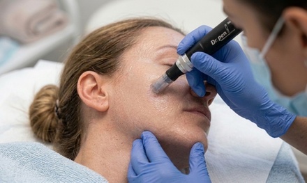 Microneedling Facial – Professional Skin Rejuvenation - Aesthetic Laser Academy