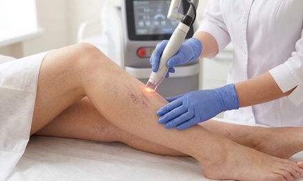 One Laser Vein-Removal Treatment for Legs - Royal Medical Health Rio Rancho