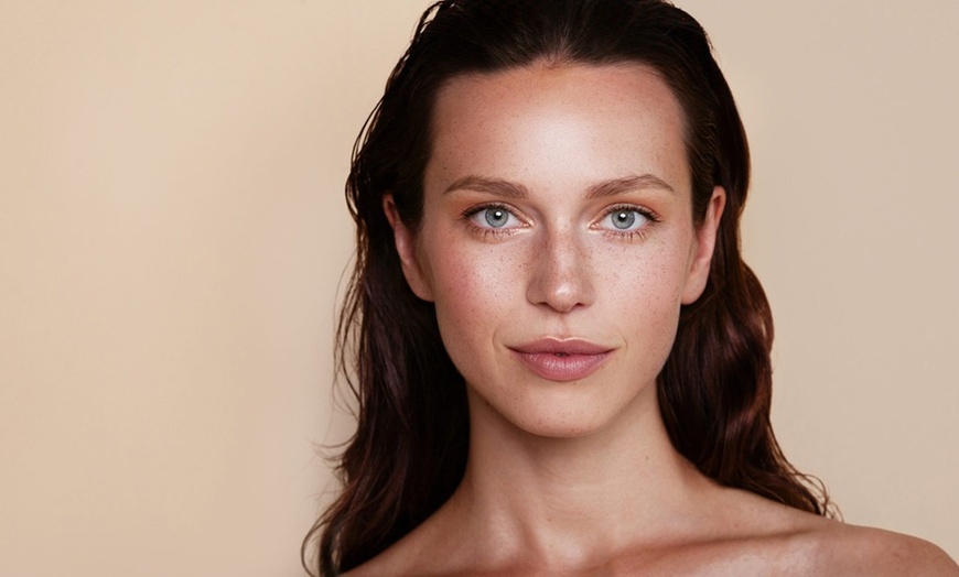 Image 3: Refresh Your Appearance with 20 or 40 Units of Botox