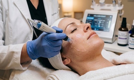 One NanoFusion Facial - Needle Free Micro Needling - Chuck Georgies Skincare and Wellness