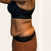 Image 3: Emerald Laser Total Body Fat Loss at Your Sculpt Studio DC