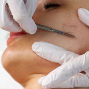 derma plane facial - Paris Beaute