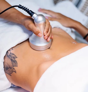 One 60-Minute Emsculpt Body Contouring Session - My Beauty Secrets