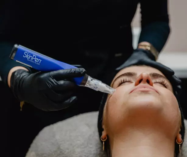 Vi Peel or BioRe3 No Peel Peel (Package of 3)