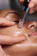 Microneedling with Salmon Sperm DNA Peptides for Face Or Neck With Bonus LED Therapy