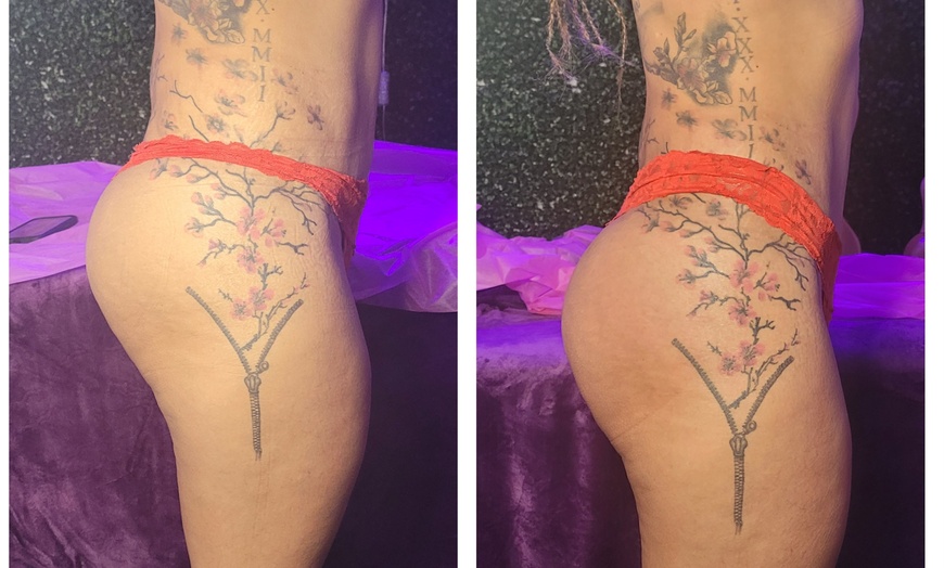 Image 2: Sculpted Curves & Revitalized Feel with Body Contouring Treatments