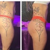Image 2: Sculpted Curves & Revitalized Feel with Body Contouring Treatments